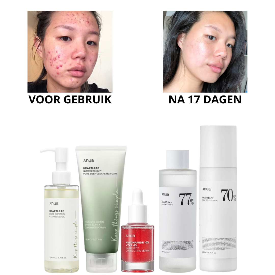 Anua | Ultieme Huid Routine Set