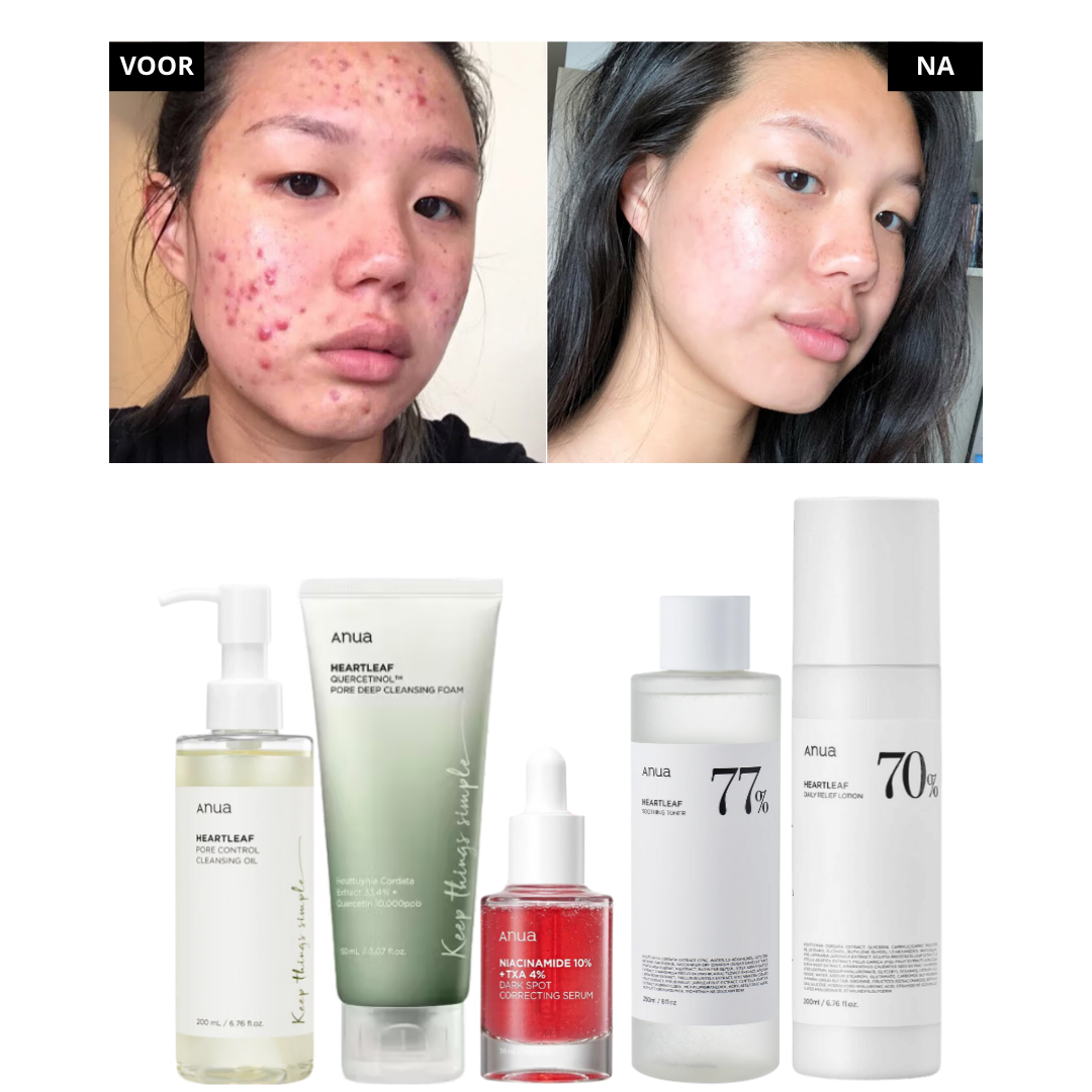 Anua | 5 Step Routine Bundle
