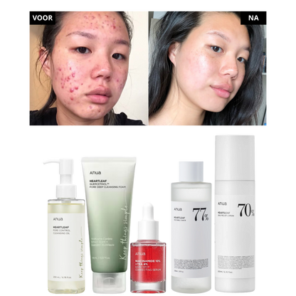 Anua | 5 Step Routine Bundle