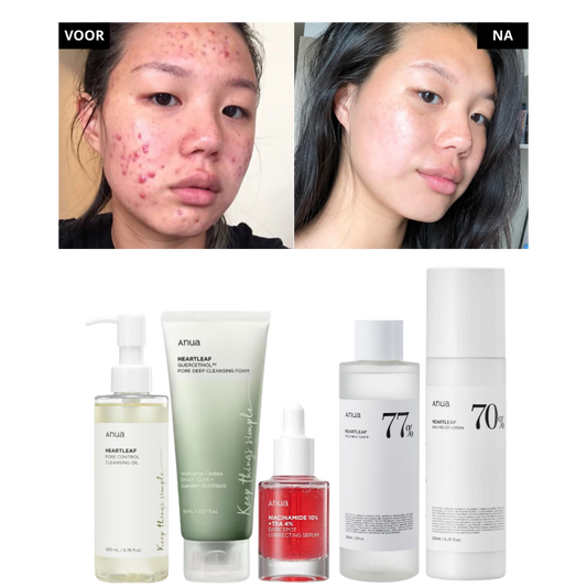 Anua | 5 Step Routine Bundle